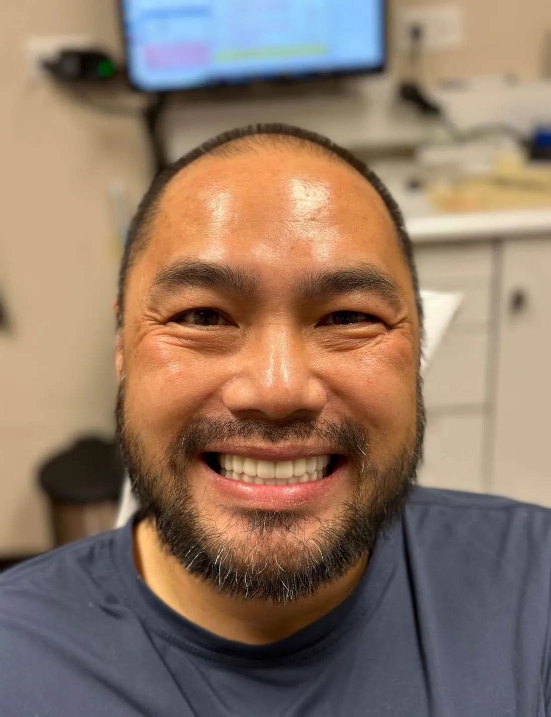 After: Full-Mouth Transformation with Implants