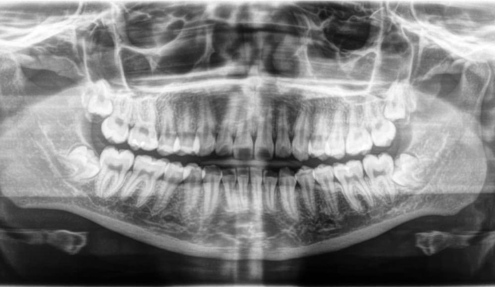 Digital xray in Elk Grove Village, IL