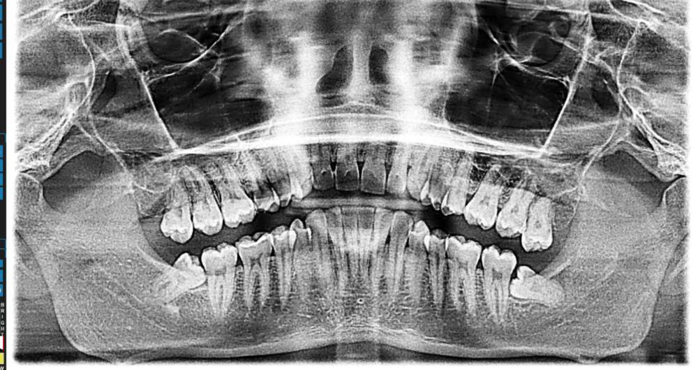 Digital xray in Elk Grove Village, IL