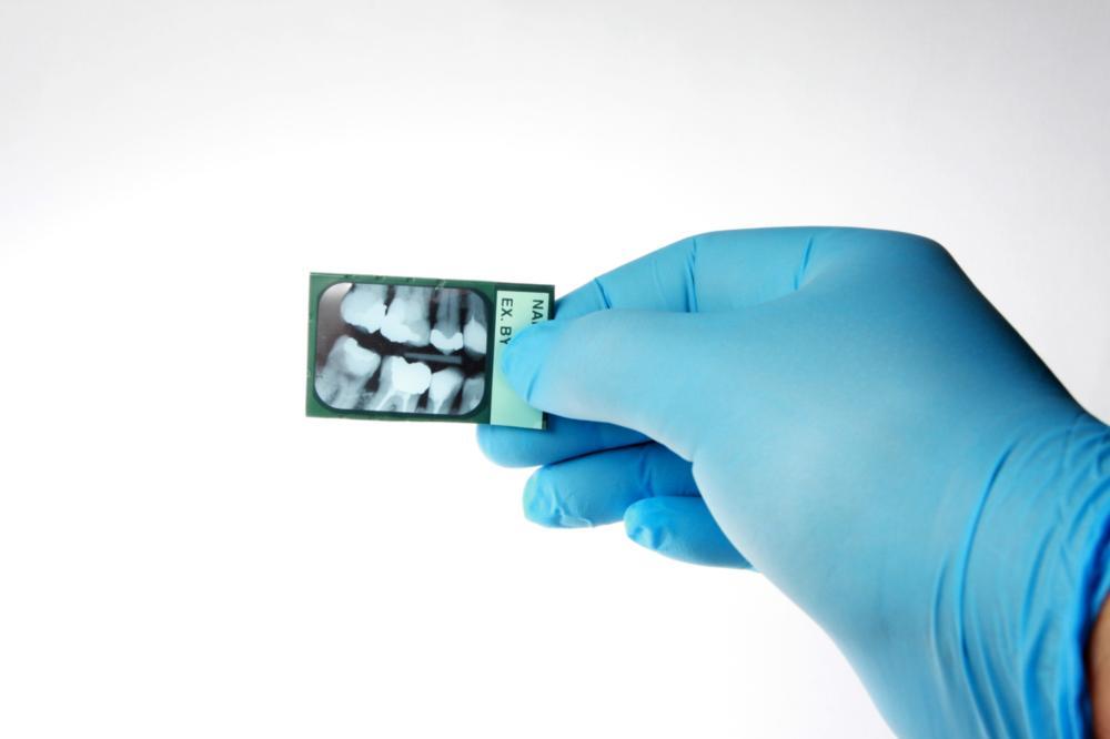 root canal elk grove village 