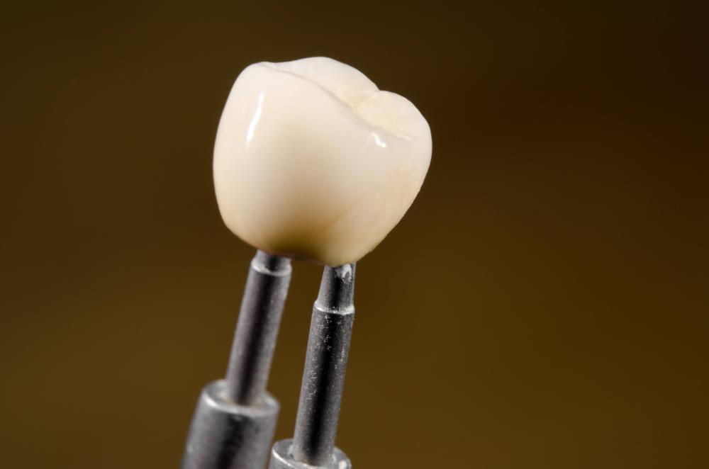 dental implants elk grove village