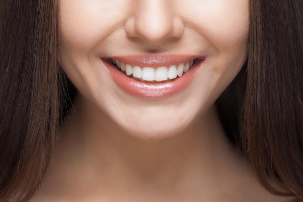 Veneers | Elk Grove Smile Center