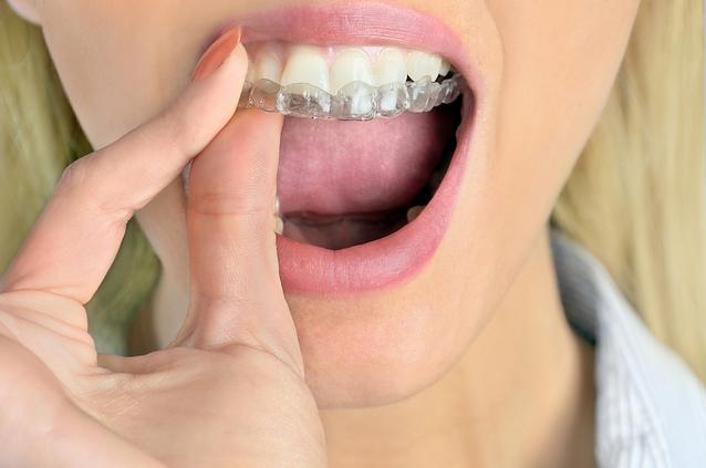 orthodontics elk grove village il