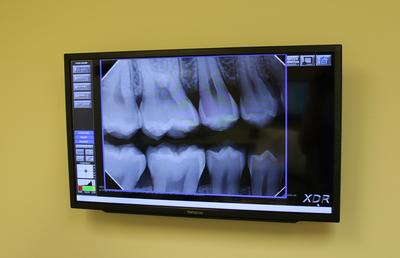X-rays in the exam room at Elk Grove Smile Center